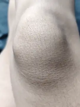 Miky Lyn online show from 02.18.26